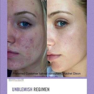 Rodan+ Fields Unblemish-Use less makeup!
